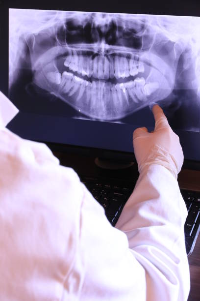 Best Emergency Dental Care for Abscessed Tooth in Emerson, GA