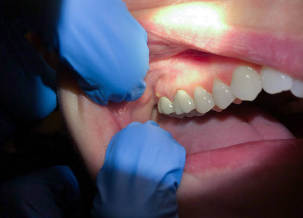 Best Orthodontic Emergency Dentist in Emerson, GA
